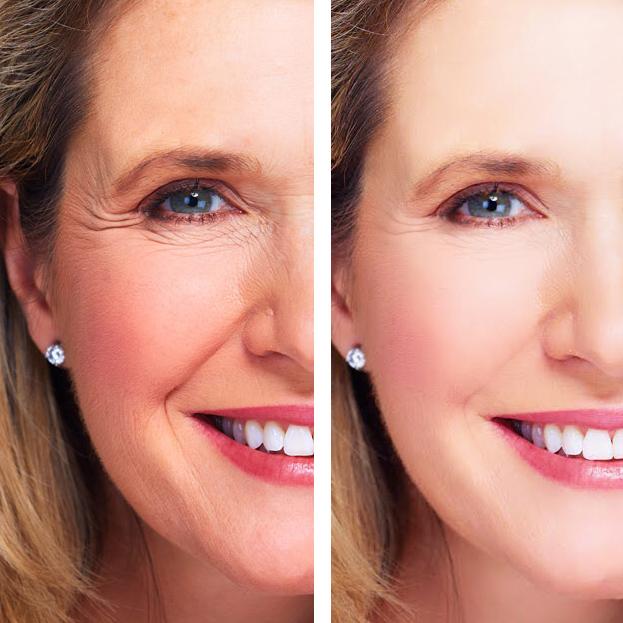 Anti-Aging Eye Repair Cream + Serum Set
