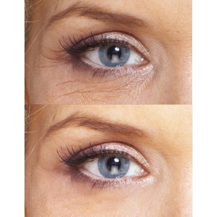 Anti-Aging Eye Repair Cream + Serum Set