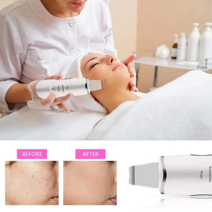 3-in-1 Ultrasonic Facial Spatula For Deep Cleansing