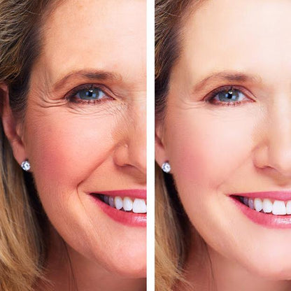 Anti-Aging Eye Repair Cream + Serum Set